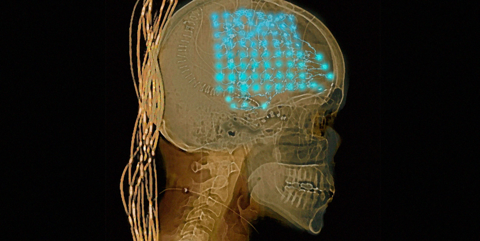 Neurocientistas ouviram o cérebro das pessoas por uma semana. Encontraram um pouco de ordem e um pouco de caos