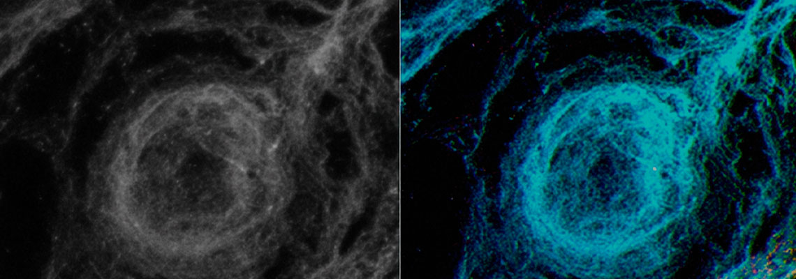 Imagem a laser permite observar ainda mais fundo em tecidos vivos
